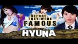 Video Music HYUNA - Before They Were Famous Gratis di zLagu.Net