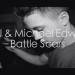 Download lagu IanJ & Michael Edward - Battle Scars (Remix) gratis