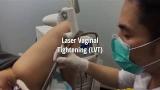 Download Lagu Laser Vaginal Tightening (LVT), Malaysia Music - zLagu.Net